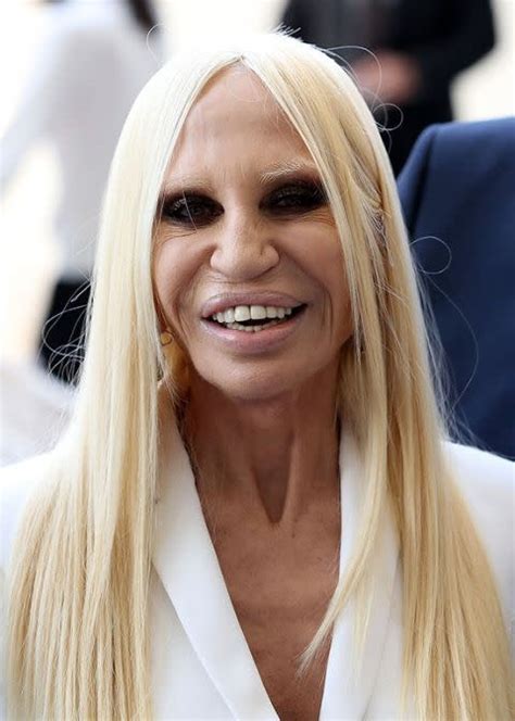 donatella versace storia|what happened to donatella versace's face.